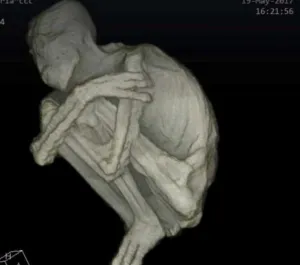 Strania mumie extraterestră din Peru